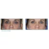 Kép 3/6 - Pep Up® Collagen Boost Face & Neck Serum
