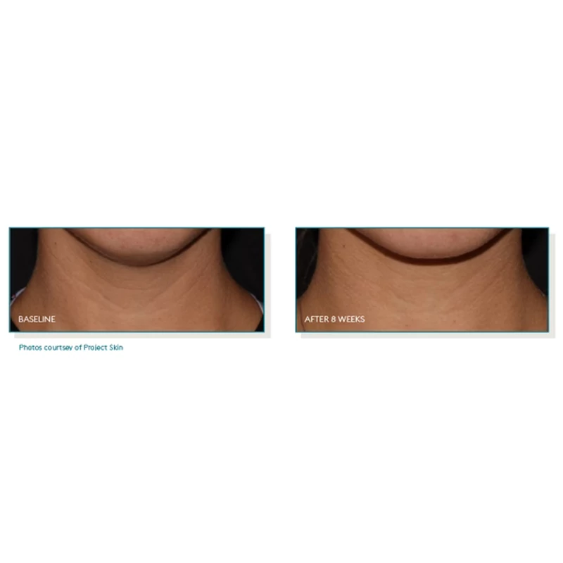 Pep Up® Collagen Boost Face & Neck Serum