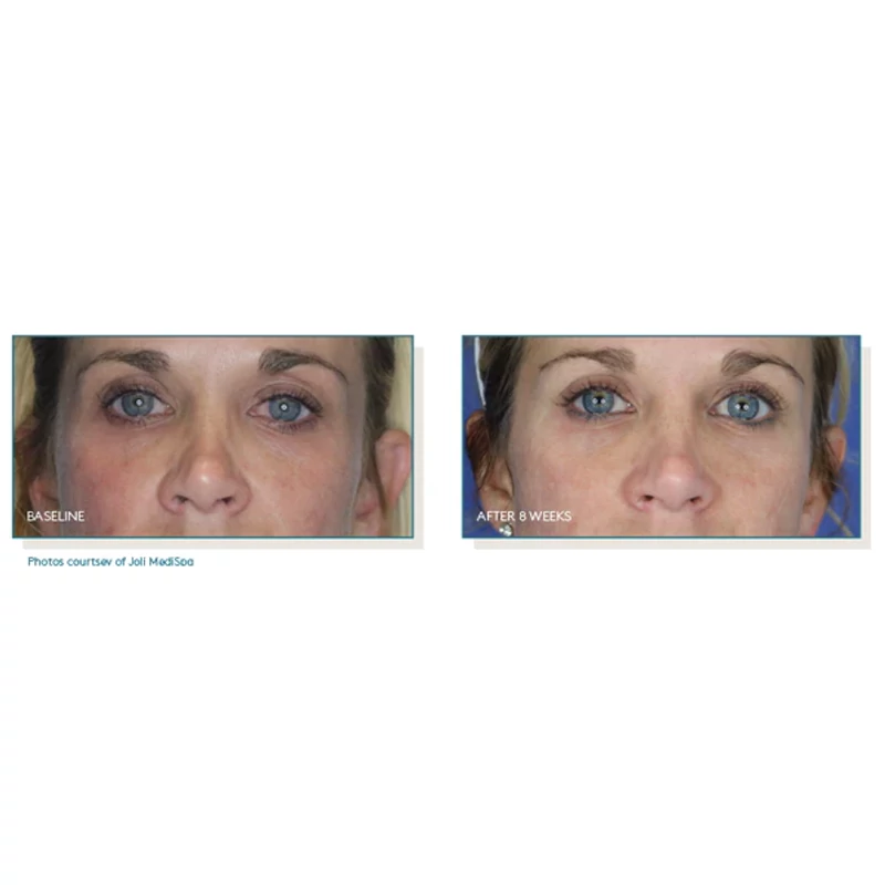 Pep Up® Collagen Boost Face & Neck Serum